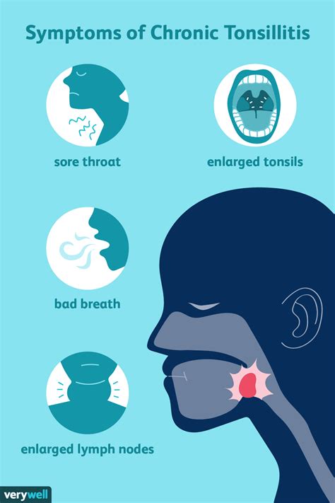 Movement of tongue is painful. . Chronic lingual tonsillitis symptoms